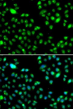 Anti- L3MBTL3 antibody produced in rabbit