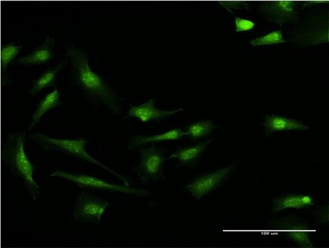 Monoclonal Anti-S100P antibody produced in mouse clone 4E7, purified immunoglobulin, buffered aqueous solution