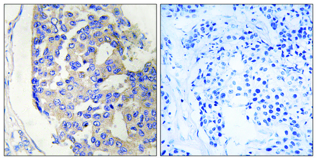 Anti-C1S, C-Terminal antibody produced in rabbit affinity isolated antibody