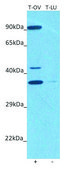 Anti-YTHDC1 (N-terminal) antibody produced in rabbit affinity isolated antibody