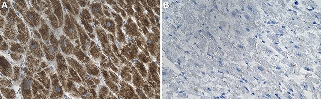 Anti-ATP5A1 Antibody, clone 1J7 ZooMAb&#174; Rabbit Monoclonal recombinant, expressed in HEK 293 cells