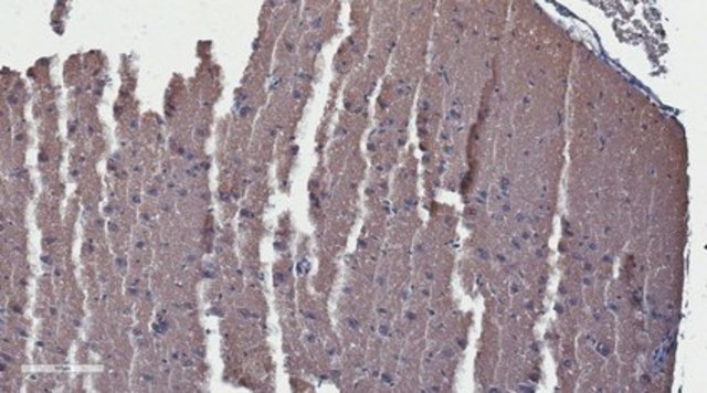 Anti-Substance P Receptor from rabbit, purified by affinity chromatography