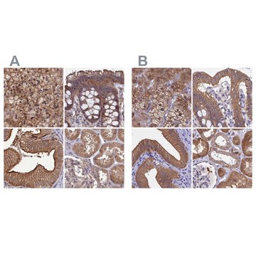 抗-STUB1 兔抗 Prestige Antibodies&#174; Powered by Atlas Antibodies, affinity isolated antibody, buffered aqueous glycerol solution