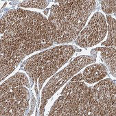 Anti-PPCS antibody produced in rabbit Prestige Antibodies® Powered by Atlas Antibodies, affinity isolated antibody, buffered aqueous glycerol solution