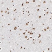 Anti-ILKAP antibody produced in rabbit Prestige Antibodies® Powered by Atlas Antibodies, affinity isolated antibody, buffered aqueous glycerol solution