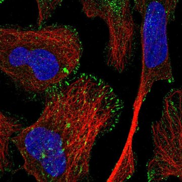 Anti-TRIM62 antibody produced in rabbit Prestige Antibodies&#174; Powered by Atlas Antibodies, affinity isolated antibody