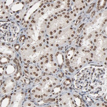 Anti-RPS6KA3 antibody produced in rabbit Prestige Antibodies&#174; Powered by Atlas Antibodies, affinity isolated antibody, buffered aqueous glycerol solution