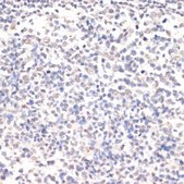 Anti-Phospho-Jak2-Y1007/1008 antibody produced in rabbit