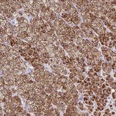Anti-FDX1 antibody produced in rabbit Prestige Antibodies® Powered by Atlas Antibodies, affinity isolated antibody, buffered aqueous glycerol solution
