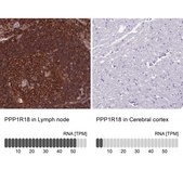 Anti-PPP1R18 antibody produced in rabbit Prestige Antibodies® Powered by Atlas Antibodies, affinity isolated antibody, buffered aqueous glycerol solution
