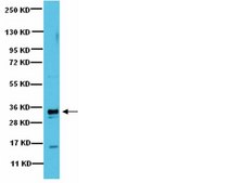 Anti-PP6C Antibody from rabbit