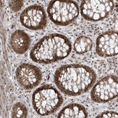 Anti-C1orf52 antibody produced in rabbit Prestige Antibodies® Powered by Atlas Antibodies, affinity isolated antibody, buffered aqueous glycerol solution