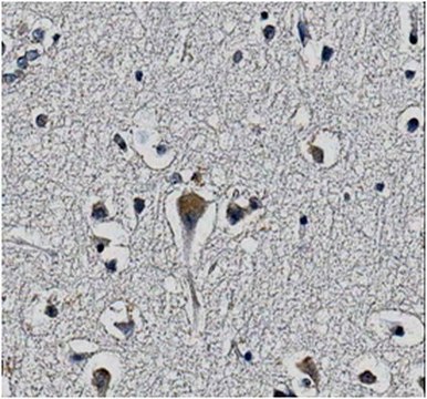 Anti-KChIP2 potassium channel subunit Antibody, clone 60/73 clone 60/73, from mouse