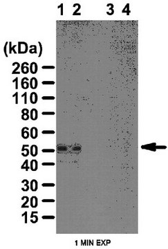 Anti-phospho PKA-RII (Ser96) Antibody from rabbit, purified by affinity chromatography