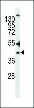 ANTI-ZDHHC20(N-TERMINAL) antibody produced in rabbit affinity isolated antibody, buffered aqueous solution