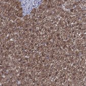 Anti-GRHPR antibody produced in rabbit Prestige Antibodies® Powered by Atlas Antibodies, affinity isolated antibody, buffered aqueous glycerol solution