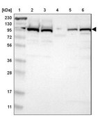 Anti-USP5 antibody produced in rabbit Prestige Antibodies® Powered by Atlas Antibodies, affinity isolated antibody, buffered aqueous glycerol solution