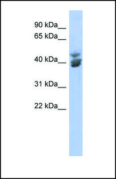 Anti-KLF2 antibody produced in rabbit affinity isolated antibody