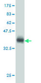 Monoclonal Anti-ACADVL antibody produced in mouse clone 5D3, purified immunoglobulin, buffered aqueous solution