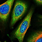 Anti-ARHGAP18 antibody produced in rabbit Prestige Antibodies® Powered by Atlas Antibodies, affinity isolated antibody, buffered aqueous glycerol solution