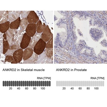 Anti-ANKRD2 antibody produced in rabbit Prestige Antibodies&#174; Powered by Atlas Antibodies, affinity isolated antibody, buffered aqueous glycerol solution