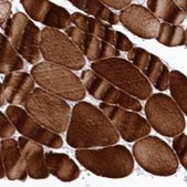 Anti-SNED1 antibody produced in rabbit Prestige Antibodies® Powered by Atlas Antibodies, affinity isolated antibody, buffered aqueous glycerol solution