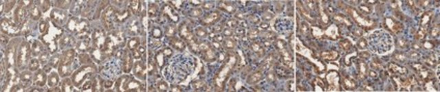 Anti-AGE Antibody, Methylglyoxal Antibody, clone 3D11 clone 3D11, from mouse