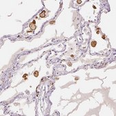 Anti-MRC1 antibody produced in rabbit Prestige Antibodies® Powered by Atlas Antibodies, affinity isolated antibody, buffered aqueous glycerol solution