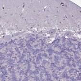 Anti-SLC15A3 antibody produced in rabbit Prestige Antibodies® Powered by Atlas Antibodies, affinity isolated antibody, buffered aqueous glycerol solution