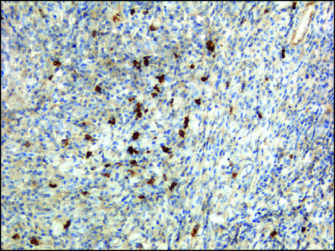 Anti-Human IgA antibody, Rabbit monoclonal recombinant, expressed in HEK 293 cells, clone RM128, purified immunoglobulin