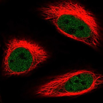 Anti-HMG20B antibody produced in rabbit Prestige Antibodies&#174; Powered by Atlas Antibodies, affinity isolated antibody