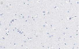 Anti-Stathmin-2 Antibody, clone 1B3 ZooMAb® Rabbit Monoclonal recombinant, expressed in HEK 293 cells