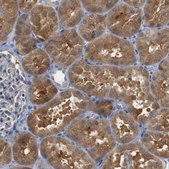 Anti-CREB3L2 antibody produced in rabbit Prestige Antibodies® Powered by Atlas Antibodies, affinity isolated antibody, buffered aqueous glycerol solution