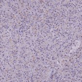 Anti-ADD2 antibody produced in rabbit Prestige Antibodies® Powered by Atlas Antibodies, affinity isolated antibody, buffered aqueous glycerol solution