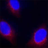 Anti-PMEL antibody, Mouse monoclonal clone PL-19, purified from hybridoma cell culture