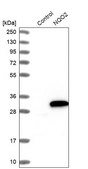 Anti-NQO2 antibody produced in rabbit Prestige Antibodies® Powered by Atlas Antibodies, affinity isolated antibody, buffered aqueous glycerol solution, Ab2