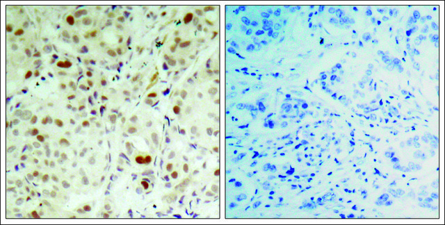 Anti-phospho-RB1 (pSer807) antibody produced in rabbit affinity isolated antibody