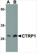 Anti-CTRP1 (ab2) antibody produced in rabbit affinity isolated antibody, buffered aqueous solution
