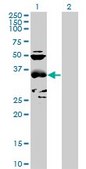 Anti-CCBL1 antibody produced in mouse purified immunoglobulin, buffered aqueous solution
