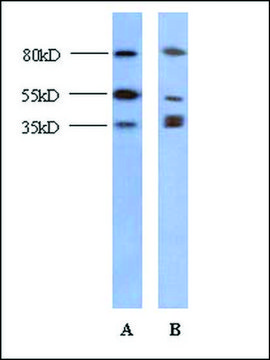 Anti-CSDA (AB2) antibody produced in rabbit IgG fraction of antiserum