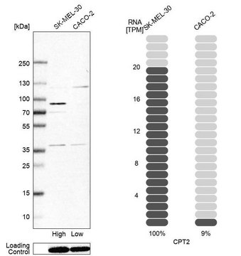 Anti-CPT2 antibody produced in rabbit Prestige Antibodies&#174; Powered by Atlas Antibodies, affinity isolated antibody, buffered aqueous glycerol solution, ab1