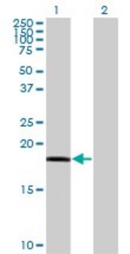 Monoclonal Anti-RARRES3 antibody produced in mouse clone 1H5, purified immunoglobulin, buffered aqueous solution