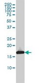 Monoclonal Anti-UBE2L3 antibody produced in mouse clone 3B7, purified immunoglobulin, buffered aqueous solution