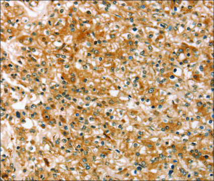 Anti-SLC40A1 antibody produced in rabbit affinity isolated antibody