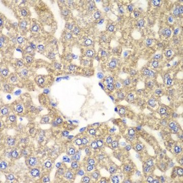 Anti-ALDH2 antibody produced in rabbit