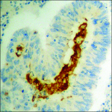 Anti-phospho-STAT2 (pTyr690) antibody produced in rabbit affinity isolated antibody