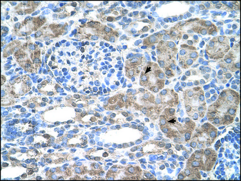 Anti-IFI44L IgG fraction of antiserum