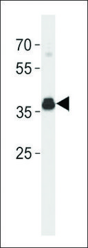 ANTI-ESR1 ISOFORM4 (C-TERM) antibody produced in rabbit affinity isolated antibody, buffered aqueous solution