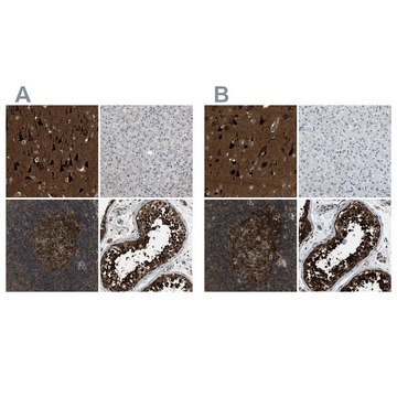 Anti-NUDCD3 antibody produced in rabbit Prestige Antibodies&#174; Powered by Atlas Antibodies, affinity isolated antibody, buffered aqueous glycerol solution, Ab2