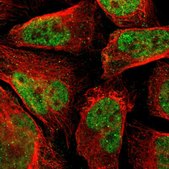 Anti-PHC1 antibody produced in rabbit Prestige Antibodies® Powered by Atlas Antibodies, affinity isolated antibody, buffered aqueous glycerol solution